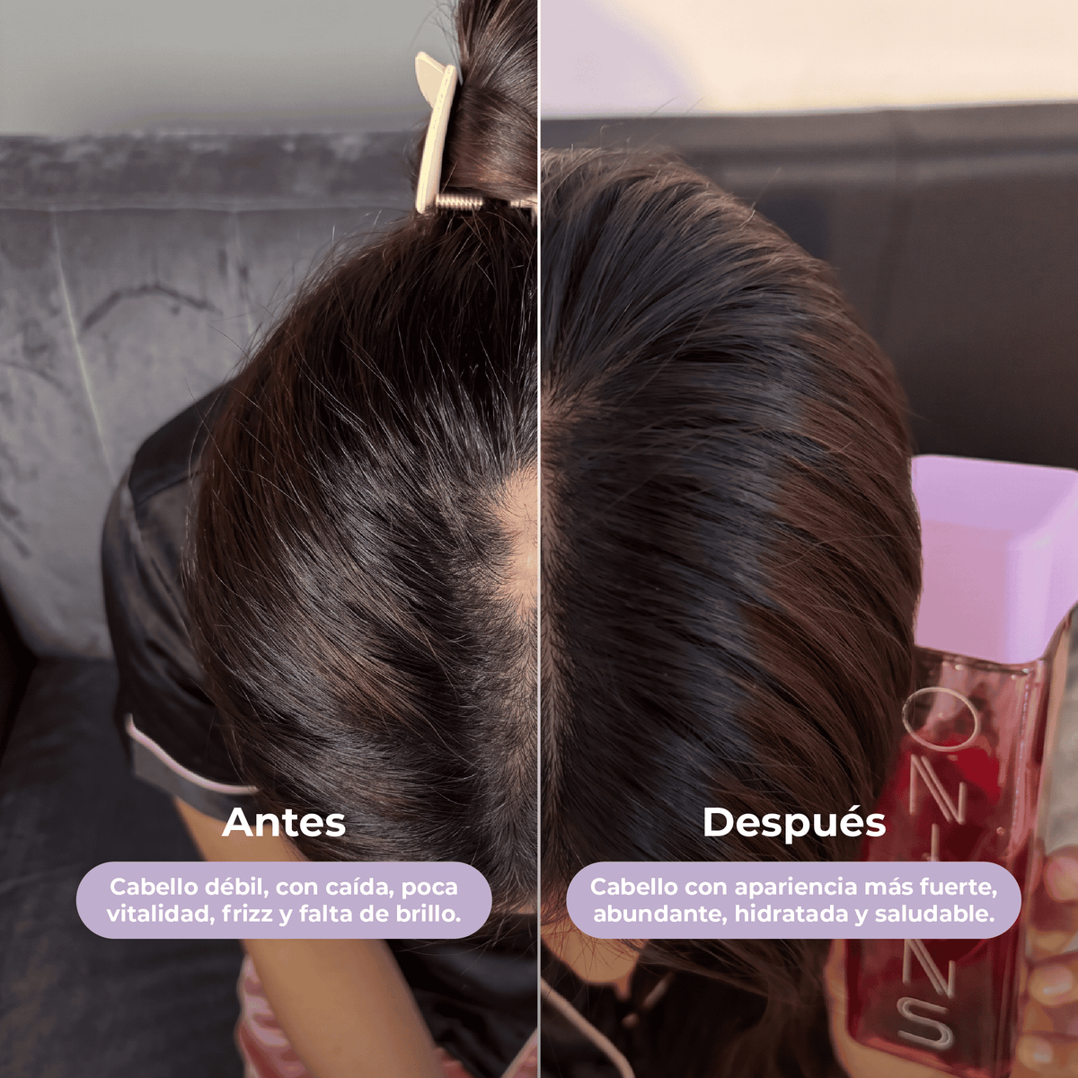 Shampoo, Acondicionador y tónico