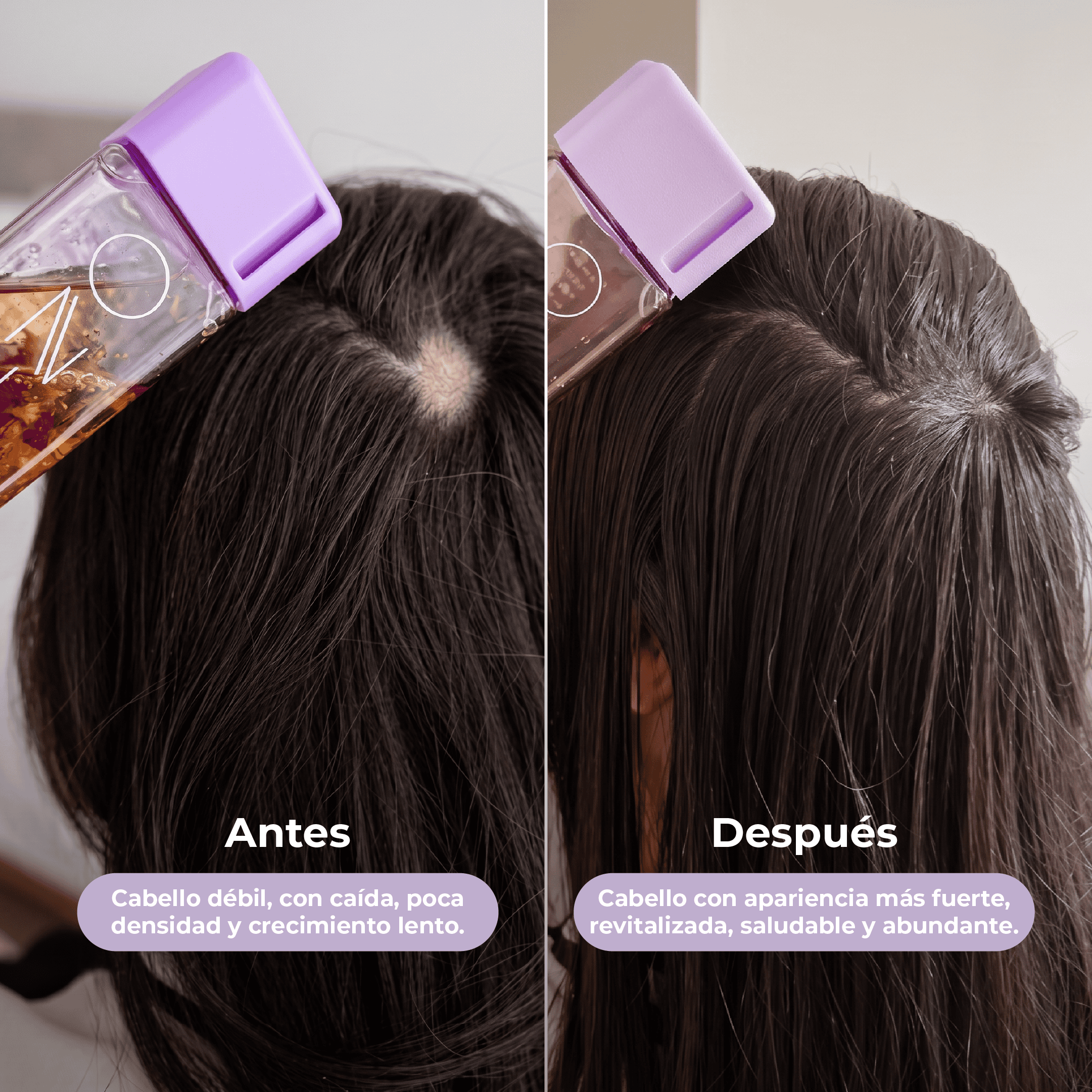 Shampoo y tónico de romero